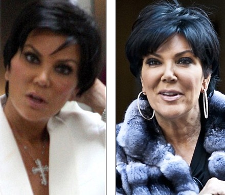 Mẹ cô Kim “siêu vòng ba” nâng cơ mặt vì đám cưới con - 2