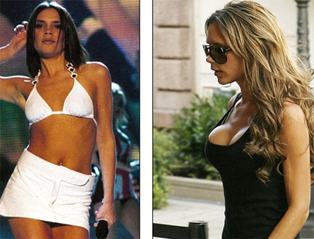 “Vòng một” của Victoria Beckham phồng xẹp bất thường - 1 Vic của năm 1997 (trái) và 2006 (phải)