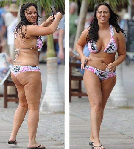 Những hình ảnh xấu xí của “sao” - 10 Chanelle Hayes lộ vùng da sần vỏ cam