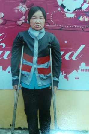Một mình bé 12 tuổi nuôi mẹ ung thư, cha suy thận mãn và chị gái bị bệnh Down - 2 Căn bệnh ung thư đã di căn vào xương nên chị Thanh phải dùng nạng để đi lại