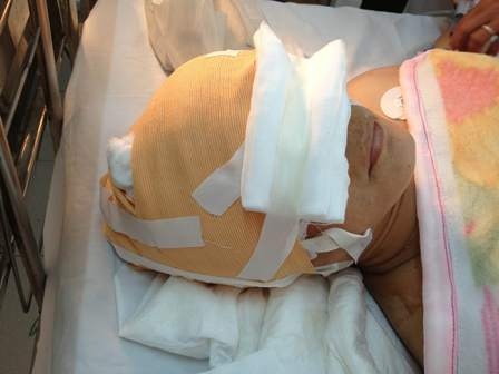 Chị H đang được điều trị tại bệnh viện ĐKTW Cần Thơ 