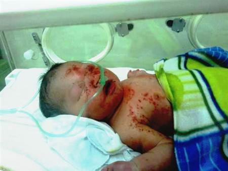 Bé Đinh Chiến Thắng ngày mới được tìm thấy trong hang đá