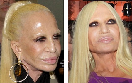 Nhà thiết kế Donatella Versace tái xuất sau khi lộ mặt cứng đơ - 3 Donatella Versace