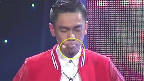Nghi án Tấn Phát uống nhầm axít để tạo scandal - 10 Tuy vậy, môi thí sinh vẫn bị bợt, mặt tái nhợt do bỏng axit.