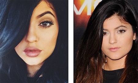 Em gái 17 tuổi của cô Kim thừa nhận bơm môi - 1 Kylie Jenner bị chỉ trích vì làm phẫu thuật khi còn ít tuổi