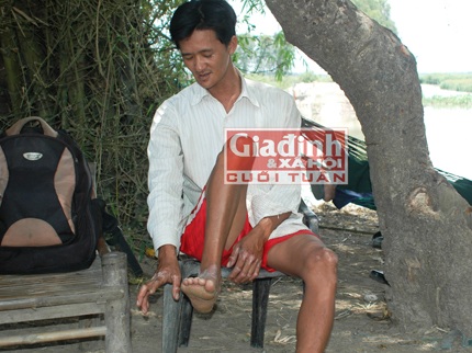 30 năm mong ngóng được mọc… răng