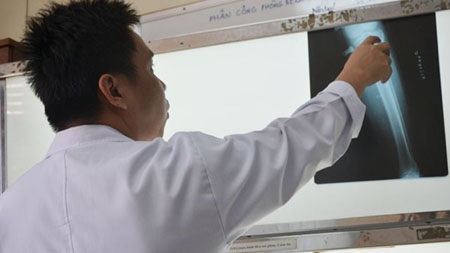 Cực hình để có chân dài - 1 Cực hình để có chân dài