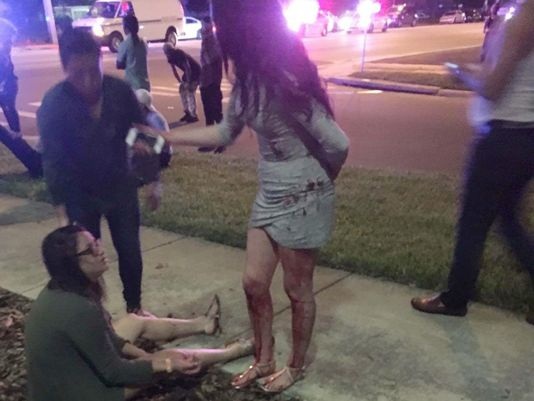 Máu dính đầy trên quần áo và người một nhân chứng sau vụ xả súng. (Ảnh: EPA)