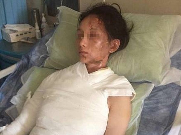 Thực khách bị đổ nước sôi và hành hung vì phàn nàn qua mạng - 1 Thực khách bị đổ nước sôi và hành hung vì phàn nàn qua mạng - 1