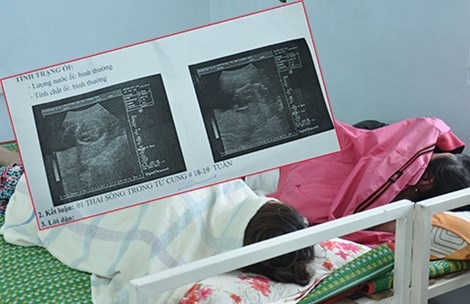 Phá thai tăng trong giới trẻ - Bài 1: Những lý do bỏ con... - 1 Nhiều em gái trẻ đi phá thai ở cơ sở “chui”. Những cái thai đã 18-19 tuần tuổi vẫn được các phòng khám thai “chui” phá vô tội vạ. Ảnh: TÙNG SƠN