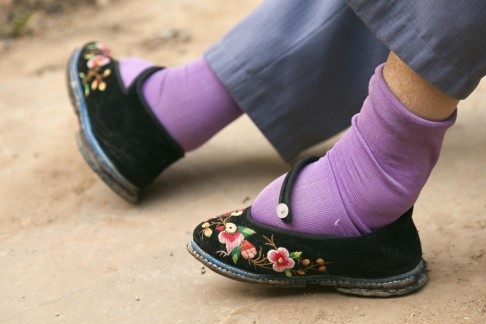 Bàn chân to do bị bó của phụ nữ Trung Quốc. Ảnh: Corbis