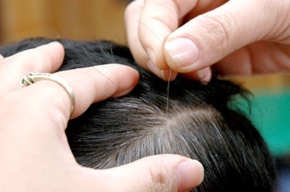 tóc bạc sớm tóc bạc sớm