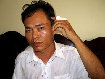 Anh Đỗ Quốc Thái - tài xế taxi Mai Linh bị ông Bùi Minh Thắng đánh vào năm 2011, gây xôn xao dư luận.