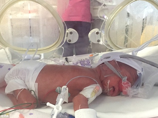 
Bé Zoe ra đời tại bệnh viện ở Dublin sau chuyến bay bão táp
