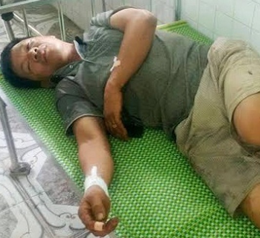 
Người dân bị hành hung phải nhập viện khi phản đối nổ mìn phá đá.
