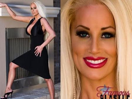 Năm 2004, Jenny Lee đến từ Austin, Texas đã xuất hiện trên chương trình của Oprah tâm sự về 59 lần phẫu thuật thẩm mỹ để có vẻ ngoài giống búp bê barbie. Bà mẹ hai con đã thực hiện vô số hình thức dao kéo như nâng ngực, độn ngực, hút mỡ, bơm môi...