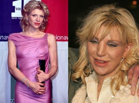 Courtney Love từng là một ngôi sao nhạc rock hàng đầu, là một diễn viên và là một nghệ sĩ thị giác thành công. Tuy nhiên, người đẹp tóc vàng đã đánh mất tất cả hào quang trong quá khứ vì lạm dụng phẫu thuật thẩm mĩ cùng một lối sống sa đọa.
