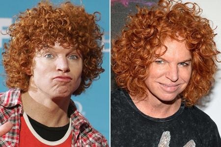 Carrot Top, tên thật là Scott Thompson là một diễn viên hài nổi tiếng với mái tóc đỏ, hài kịch đạo cụ và hài kịch dựa vào phong cách tự ti của mình. Tuy nhiên, sau khi phẫu thuật thẩm mĩ, Carrot Top đã khiến khán giả choáng váng với một diện mạo không thể nhận ra.