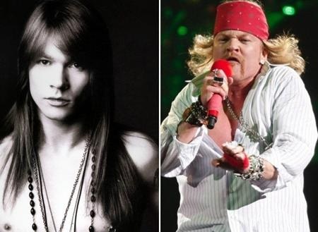 Thêm một ngôi sao đã “lột xác” hoàn toàn nhờ dao kéo. Tuy nhiên, Axl Rose lại khiến khán giả sứng sốt theo hướng tiêu cực. Hiện tại, không ai có thể nhận ra những đường nét điển trai, hào hoa ngày nào trên gương mặt thủ lĩnh ban nhạc rock Guns N Roses.