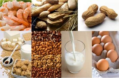 Trẻ có thể chết vì dị ứng thức ăn - 2 Trẻ có thể chết vì dị ứng thức ăn - 2
