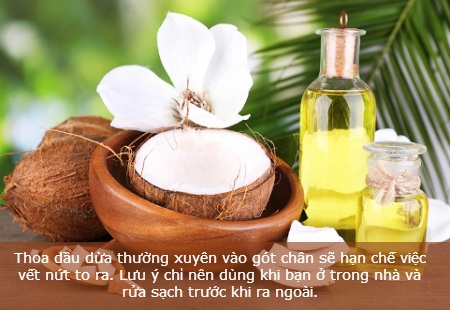 Mẹo chữa nứt gót chân đơn giản vào mùa đông - 1 Mẹo chữa nứt gót chân đơn giản vào mùa đông - 1