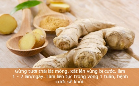 Mẹo phòng tránh và chữa cước tay chân mùa lạnh - 4 Mẹo phòng tránh và chữa cước tay chân mùa lạnh - 4