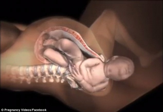 Khoảnh khắc khi đầu em bé “chui”ra ngoài được gọi là sổ