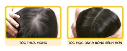 Những thảo mộc giúp ngăn rụng tóc hiệu quả - 2 Những thảo mộc giúp ngăn rụng tóc hiệu quả - 2