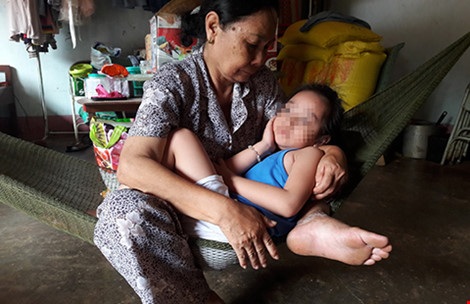 Mất trí nhớ do virus viêm não tấn công - 1 Do di chứng, bé Ph. hiện tại không nhớ được gì và chỉ biết khóc, hiếm hoi lắm mới có thể ngủ được một lát. Ảnh: HÀ PHƯỢNG