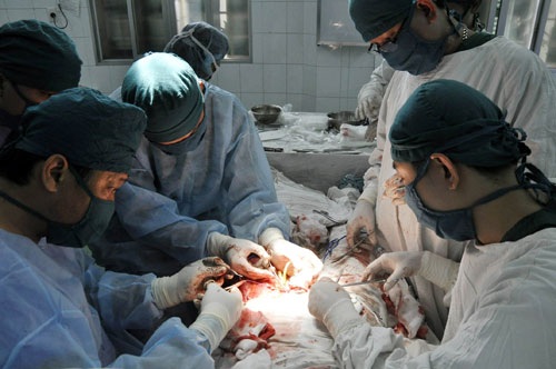 Chuyện chị em: Phiền toái với ngực “khủng” - 1 GS Trần Thiết Sơn đang thực hiện 1 ca tái tạo ngực. ảnh: Diệu Linh