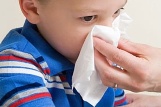 Suýt hại con vì xử lý chảy máu cam sai cách - 1 Các chuyên gia khuyến cáo, khi trẻ bị chảy máu cam, không được cho trẻ ngửa cổ lên hoặc cúi đầu quá thấp vì sẽ gây hại cho trẻ. Ảnh minh họa