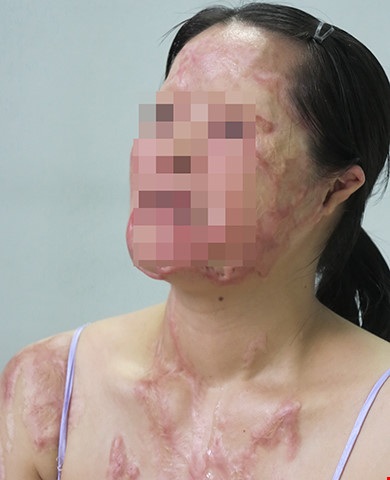 Đau thấu trời vì acid! - 2 Đau thấu trời vì acid! - 2