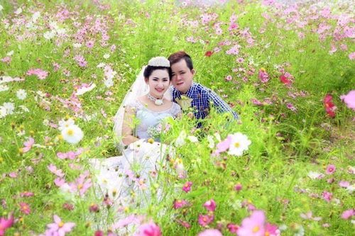 Chuyện tình đẹp của chàng trai bỏng toàn thân với cô gái 9X - 2
Ảnh cưới đẹp như mơ của đôi tình nhân vượt qua mọi định kiến.