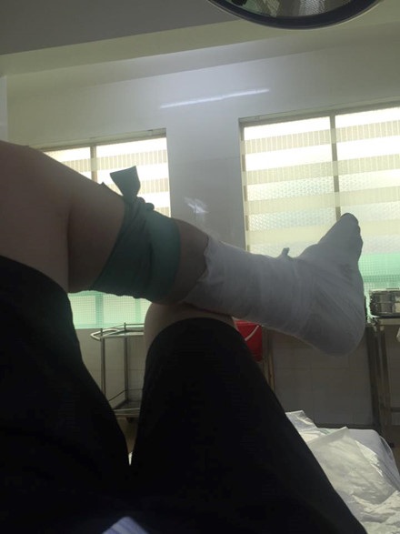 Bệnh nhân tố bác sĩ bỏ quên bông trong vết thương - 3
Bệnh nhân bức xúc, chia sẻ tâm trạng và ảnh lên mạng xã hội
