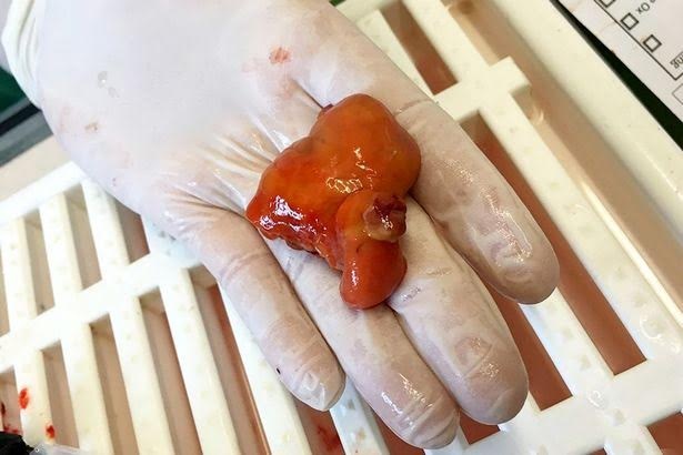Phẫu thuật loại bỏ khối u cho cá vàng - 3
Khối u siêu lớn của Nemo.