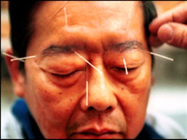 Gió lạnh thất thường, đề phòng liệt mặt, méo miệng thế nào? - 3 Ảnh minh họa.
