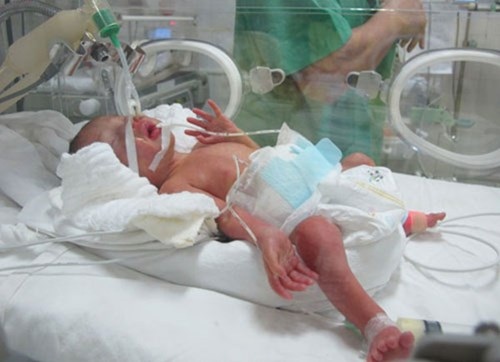 Khoảnh khắc đầu tiên và cuối cùng của người mẹ ung thư - 7 Con chị Trâm được đặt tên là Trần Gấu với mong ước bé lớn lên khỏe mạnh và mạnh mẽ. Hiện tại sức khỏe bé Gấu đã ổn hơn lúc mới sinh.