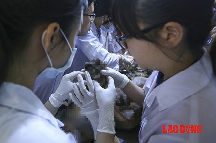 Chùm ảnh: Trăn trở của bác sĩ tương lai trong việc học với thi thể người - 9 Chùm ảnh: Trăn trở của bác sĩ tương lai trong việc học với thi thể người - 9