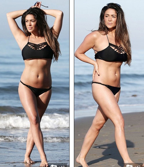 
Người đẹp Anh vốn không xa lạ với những ca phẫu thuật làm đẹp
