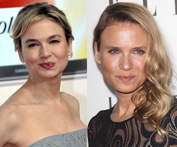 Renee Zellweger tái xuất sau tin đồn thẩm mỹ - 3
Renee Zellweger xưa và nay có quá nhiều khác biệt nhưng cô vẫn phủ nhận những tin đồn phẫu thuật thẩm mỹ