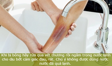 Mẹo chữa bỏng nhẹ nhờ nguyên liệu tự nhiên - 1 Mẹo chữa bỏng nhẹ nhờ nguyên liệu tự nhiên - 1
