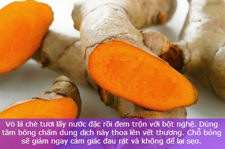 Mẹo chữa bỏng nhẹ nhờ nguyên liệu tự nhiên - 9 Mẹo chữa bỏng nhẹ nhờ nguyên liệu tự nhiên - 9