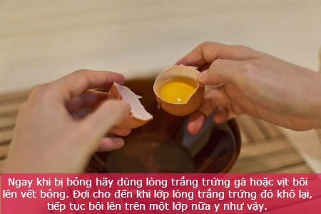 Mẹo chữa bỏng nhẹ nhờ nguyên liệu tự nhiên - 2 Mẹo chữa bỏng nhẹ nhờ nguyên liệu tự nhiên - 2