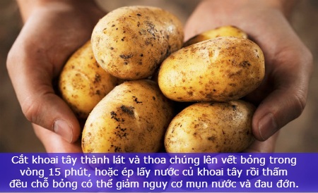 Mẹo chữa bỏng nhẹ nhờ nguyên liệu tự nhiên - 4 Mẹo chữa bỏng nhẹ nhờ nguyên liệu tự nhiên - 4