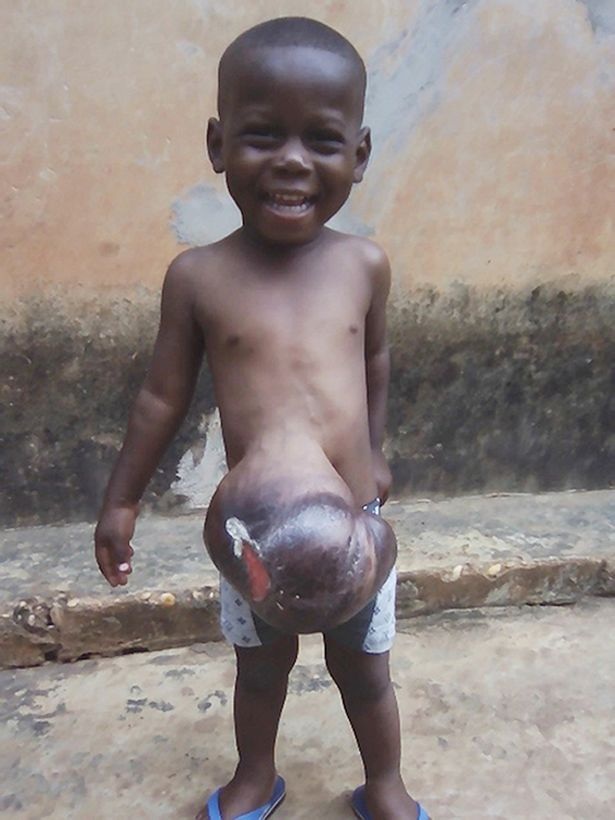 Cậu bé Ethan với chứng bệnh hiếm gặp