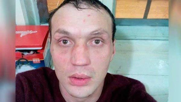 Tự huỷ hoại bản thân vì nỗi sợ bị theo dõi - 1
Alem Kulakhmedov tự huỷ hoại đôi mắt của mình vì sợ bị theo dõi.