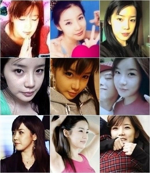 “Choáng” trước gương mặt sưng vù của Park Bom nhóm 2NE1 - 3
Nữ ca sĩ của nhóm 2NE1 trong những bức ảnh cũ với vẻ đẹp tự nhiên, trong trẻo.