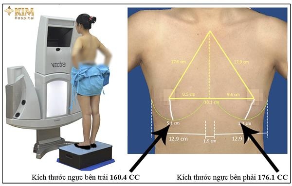 Nâng ngực nội soi 3D: Đừng bỏ qua những lưu ý quan trọng - 3 Nâng ngực nội soi 3D: Đừng bỏ qua những lưu ý quan trọng - 3