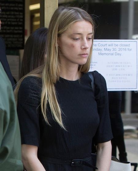 Vợ Johnny Depp òa khóc và lộ hàng loạt vết thâm tím do bị chồng đánh - 4 Amber Heard xuất hiện tiều tụy tại tòa án California