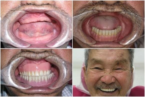 “Nụ cười hạnh phúc” mang tới 30 cơ hội làm răng miễn phí trị giá 300 triệu đồng/trường hợp - 2 “Nụ cười hạnh phúc” mang tới 30 cơ hội làm răng miễn phí trị giá 300 triệu đồng/trường hợp - 2